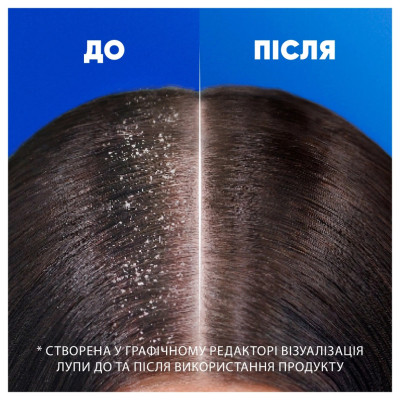 Шампунь Head & Shoulders Глибоке зволоження 250 мл (8700216605281)